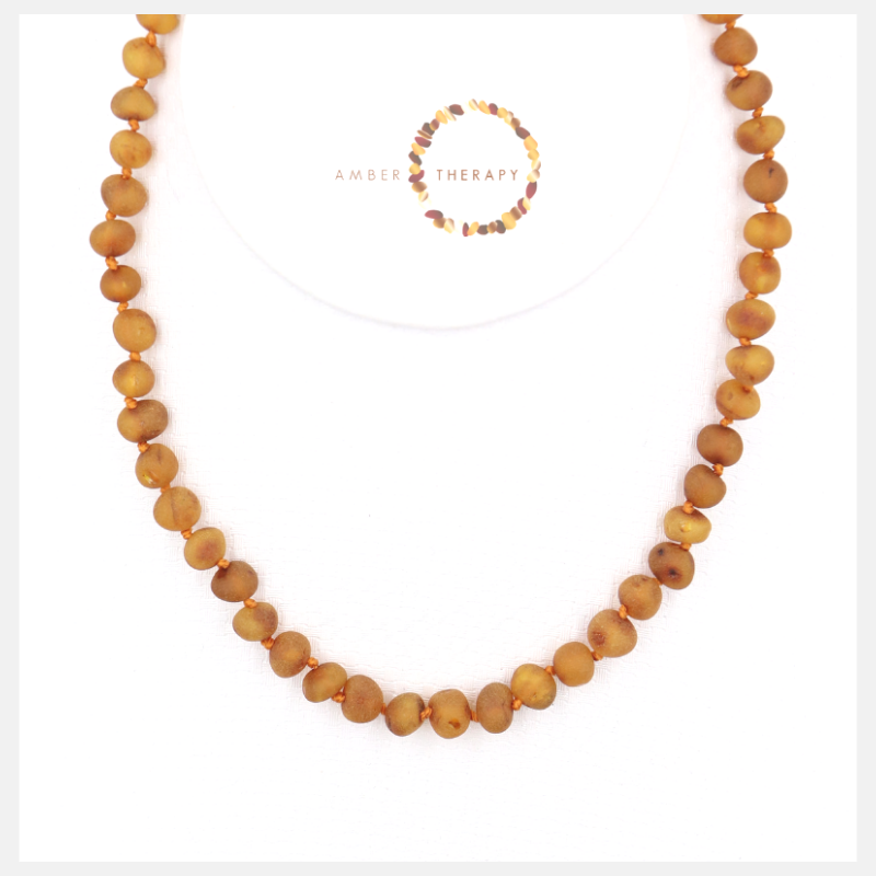 Adult Raw Toffee Amber Necklace Amber Therapy