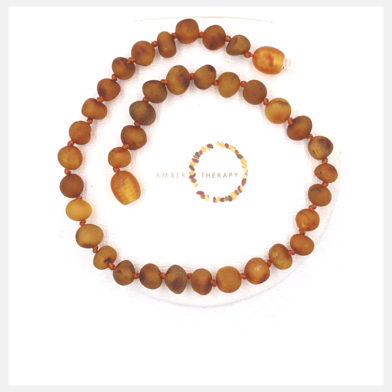 Adult Raw Toffee Amber Anklet
