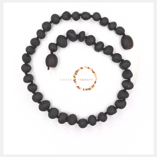 Adult Raw Cherry Amber Anklet